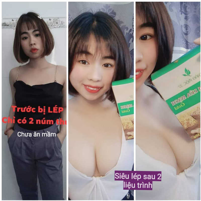 Chị Mai tăng kích thước vòng 1 chỉ với 2 liệu trình